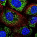 ABR Polyclonal Antibody