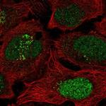 ESCO2 Polyclonal Antibody