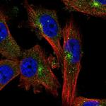 EVI5 Antibody in Immunocytochemistry (ICC/IF)