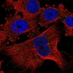 PLGLB1 Polyclonal Antibody