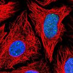 TOE1 Polyclonal Antibody