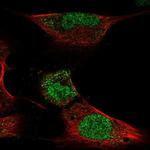 HOXC4 Antibody in Immunocytochemistry (ICC/IF)