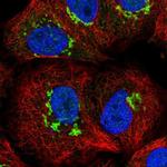 ST8SIA4 Antibody in Immunocytochemistry (ICC/IF)