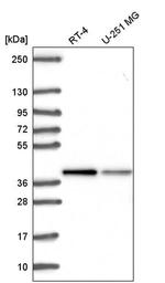 ST8SIA4 Antibody in Western Blot (WB)