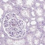 KRTAP11-1 Polyclonal Antibody