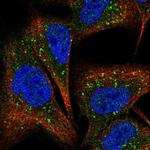 COMMD7 Polyclonal Antibody