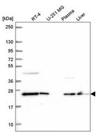 COMMD7 Antibody in Western Blot (WB)