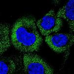 CCHCR1 Polyclonal Antibody