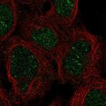 ZNF212 Polyclonal Antibody