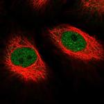 MED10 Polyclonal Antibody