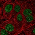 TTC5 Polyclonal Antibody