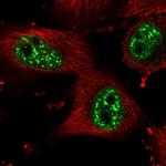 HP1BP3 Polyclonal Antibody