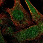 DCAF6 Polyclonal Antibody