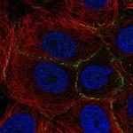 PLEKHA6 Polyclonal Antibody