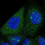 SNX7 Polyclonal Antibody