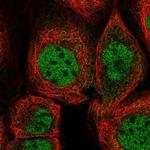 ZMAT3 Polyclonal Antibody