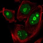 ZNF593 Polyclonal Antibody