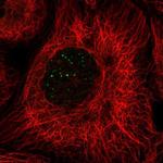 BABAM1 Polyclonal Antibody