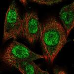 CMIP Polyclonal Antibody