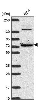 CMIP Antibody in Western Blot (WB)