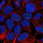 FAM69B Polyclonal Antibody