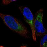 GPR65 Antibody in Immunocytochemistry (ICC/IF)