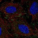 DOK5 Polyclonal Antibody