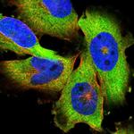 GLD2 Polyclonal Antibody