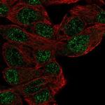 MFHAS1 Polyclonal Antibody