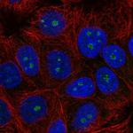 TRIM52 Polyclonal Antibody