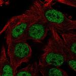 SIA7C Polyclonal Antibody