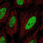 C19orf57 Polyclonal Antibody