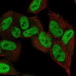 ZNF333 Polyclonal Antibody