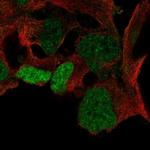 SOX3 Polyclonal Antibody