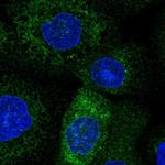 TMCO1 Antibody in Immunocytochemistry (ICC/IF)