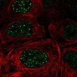 FBXO48 Polyclonal Antibody