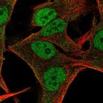 ITGB1BP3 Polyclonal Antibody