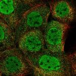 ZMYM4 Polyclonal Antibody