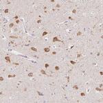 PNMAL2 Antibody in Immunohistochemistry (IHC)