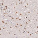 PNMAL2 Polyclonal Antibody