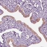 C2orf81 Antibody in Immunohistochemistry (IHC)