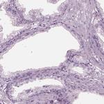 C2orf81 Antibody in Immunohistochemistry (IHC)