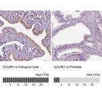 C2orf81 Antibody