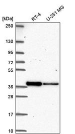 DTWD2 Antibody in Western Blot (WB)