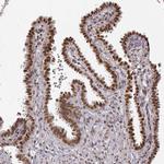 RAI1 Antibody in Immunohistochemistry (IHC)