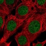 RAI1 Polyclonal Antibody