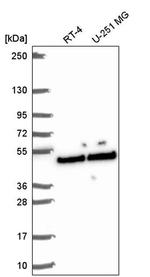 SLFNL1 Antibody in Western Blot (WB)