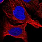 ATMIN Polyclonal Antibody