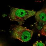 GPATCH3 Polyclonal Antibody