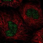 NABP1 Polyclonal Antibody